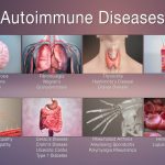 What is an autoimmune disease?