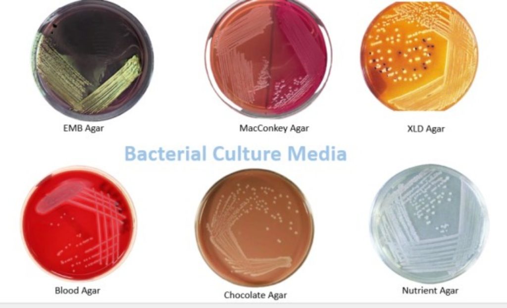 Types of culture media used in microbiology