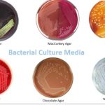Types of culture media used in microbiology