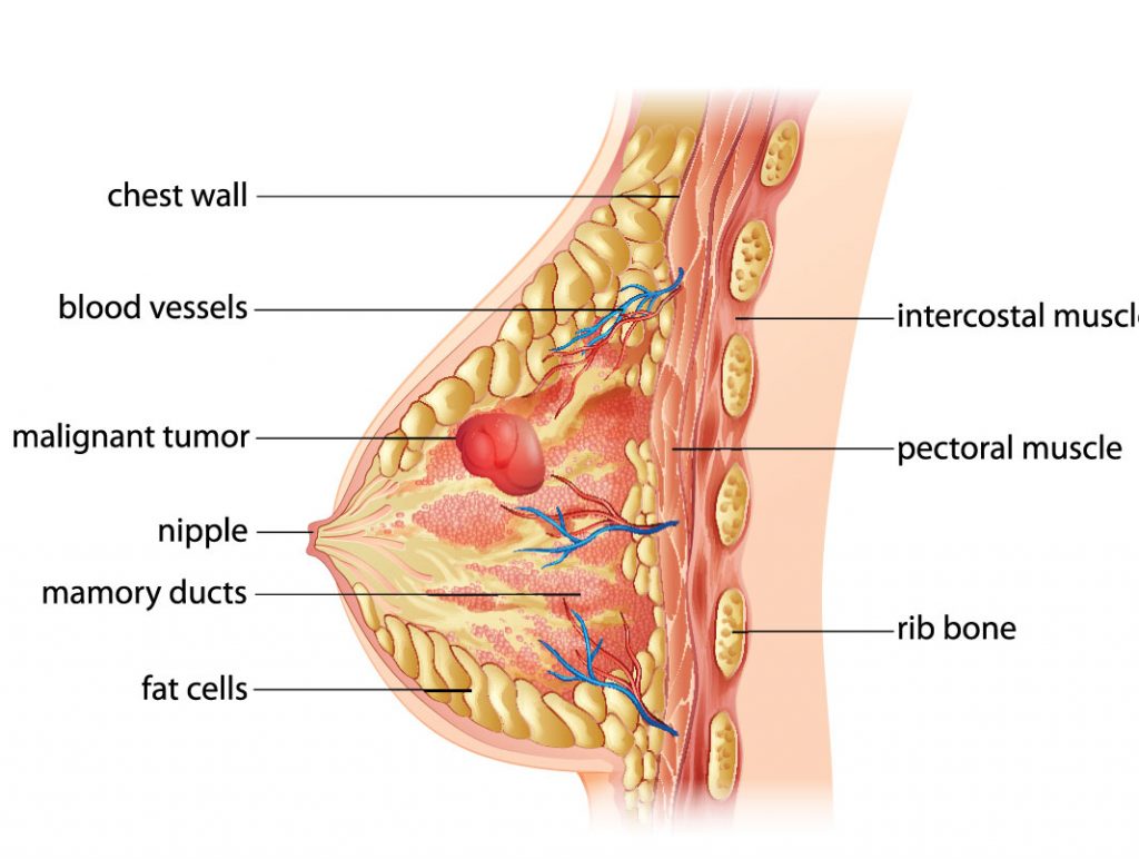 An Answer to Breast Cancer? A New Vaccine Could Prevent Its Most Aggressive Form