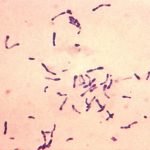 Laboratory diagnosis, treatment and prevention of Corynebacterium diphtheriae