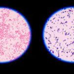 Gram Staining: Principle, Procedure, Interpretation, Examples and Animation