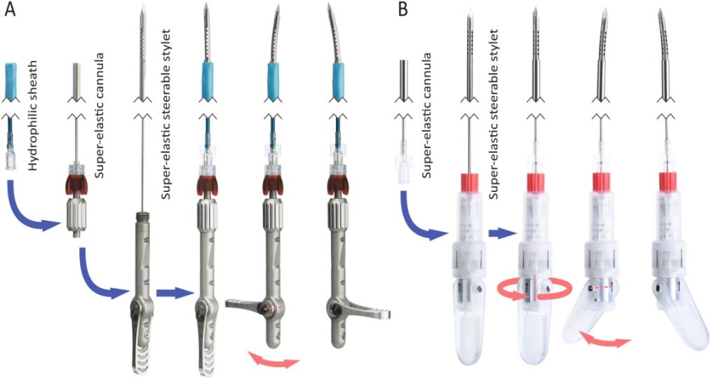 Sensor integrated into RFA needle offers surgical accuracy