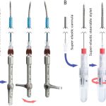 Sensor integrated into RFA needle offers surgical accuracy
