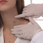 What are benign tumors?